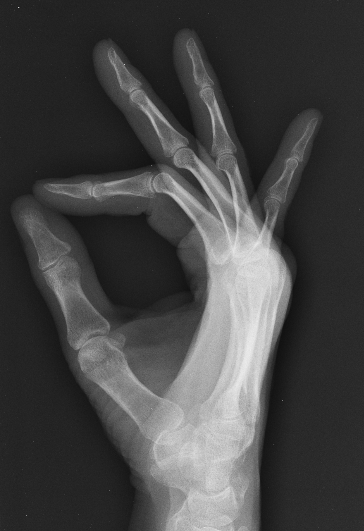 Xray 4